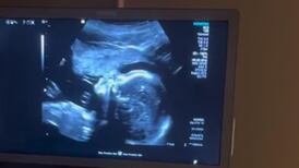 VIDEO | Captan a feto “cantando” durante ultrasonido y sorprende a todos en redes sociales
