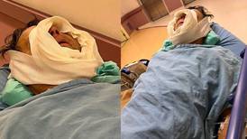¡Impactante! Alfredo Adame comparte cómo quedó su rostro luego de la cirugía en el ojo