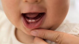 Maternidad: ¿Por qué los bebés nacen con dientes?