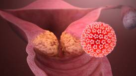 Salud: ¿Cuánto tarda el virus del papiloma humano para volverse cáncer?