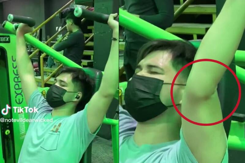 Se lastimó el codo por no realizar los ejercicios correctamente.