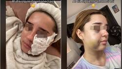 FOTO: ¡Irreconocible! Joven mujer se hace cirugía estética y casi muere