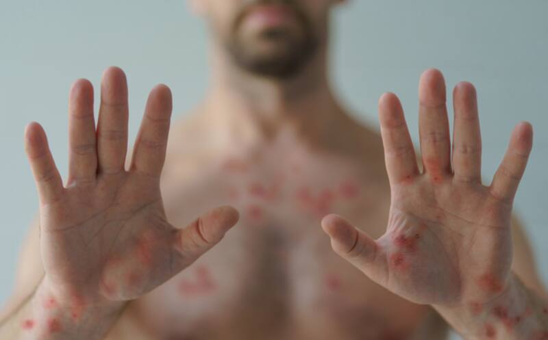 México tiene el mayor índice de muertes en todo el continente americano.