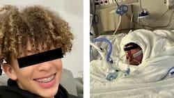 Joven termina desfigurado y con el 75% del cuerpo quemado por reto de TikTok