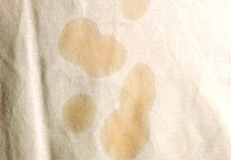 Quitas las manchas de aceite de la ropa puede ser un gran desafío y el tiempo no es un aliado. Por eso se recomienda actuar rápido para disminuír la dificultad en la limpieza.