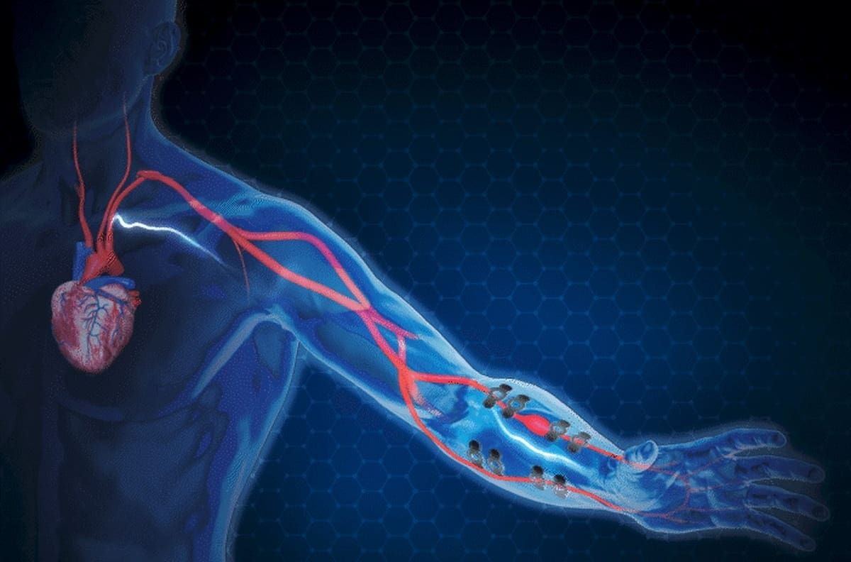 Tatuaje de grafeno, la revolucionaria solución para medir y controlar la presión arterial