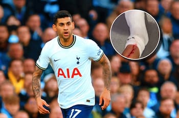 VIDEO | Cuti Romero le abrió la pierna a un compañero del Tottenham en la pretemporada