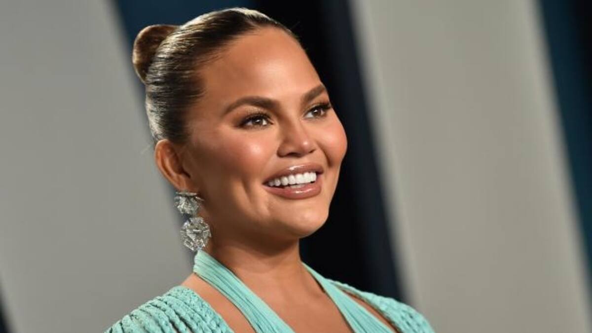Chrissy Teigen: así cambió su rostro con cirugía en las mejillas