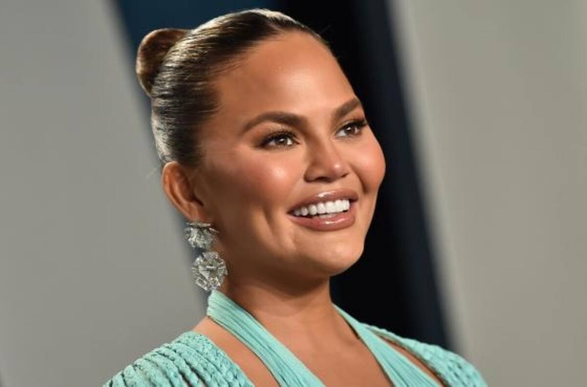 Chrissy Teigen: así cambió su rostro con cirugía en las mejillas