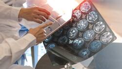 ¿Qué es la Esclerosis Múltiple y cuáles son sus síntomas?