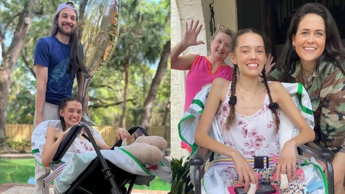 Modelo sufre amputación de ambas piernas por complicaciones de COVID-19