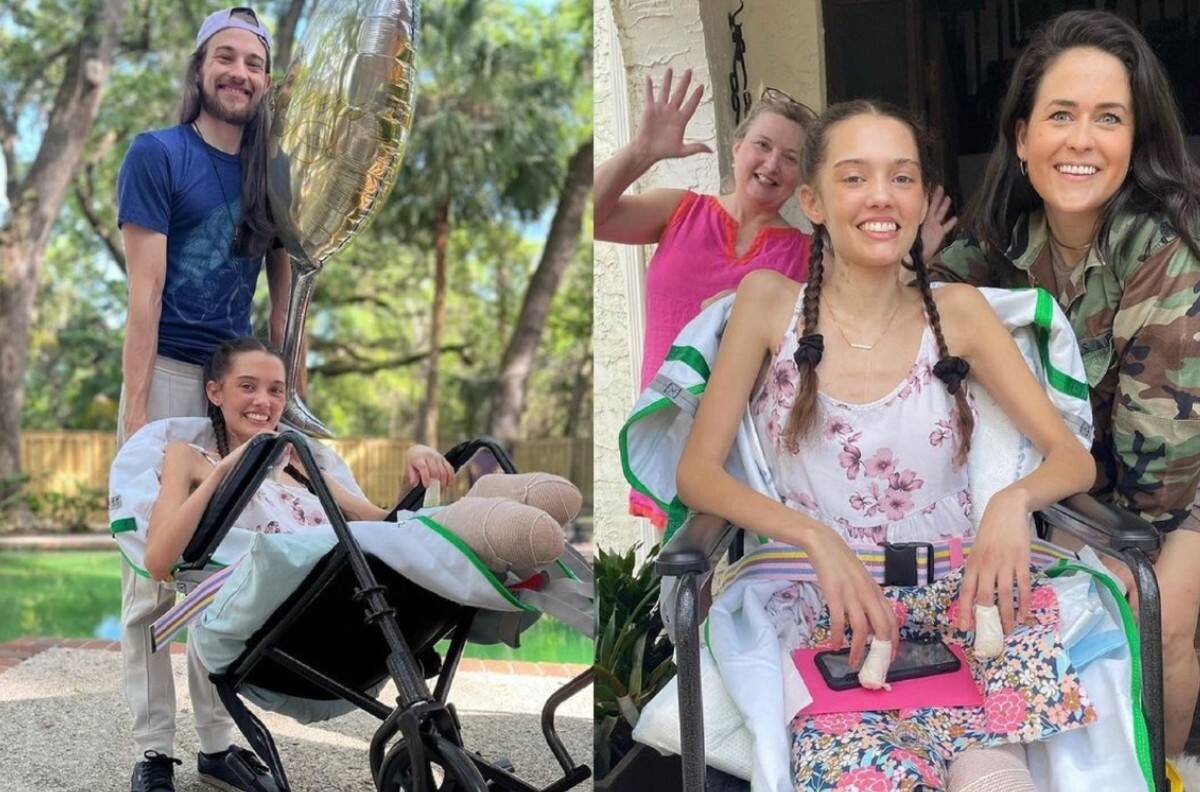 Modelo sufre amputación de ambas piernas por complicaciones de COVID-19