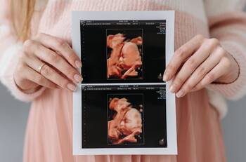 Maternidad: Estas son las mejores apps para hacer seguimiento de tu embarazo