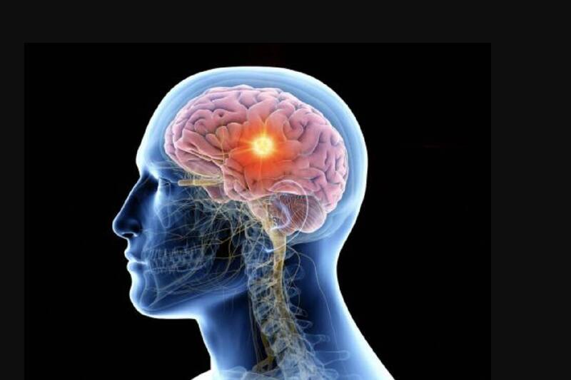 El Vorasidenib es un medicamento que frena el avance de un tumor cerebral.