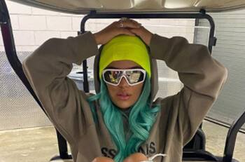 Karol G muestra las consecuencias que le dejó su caída