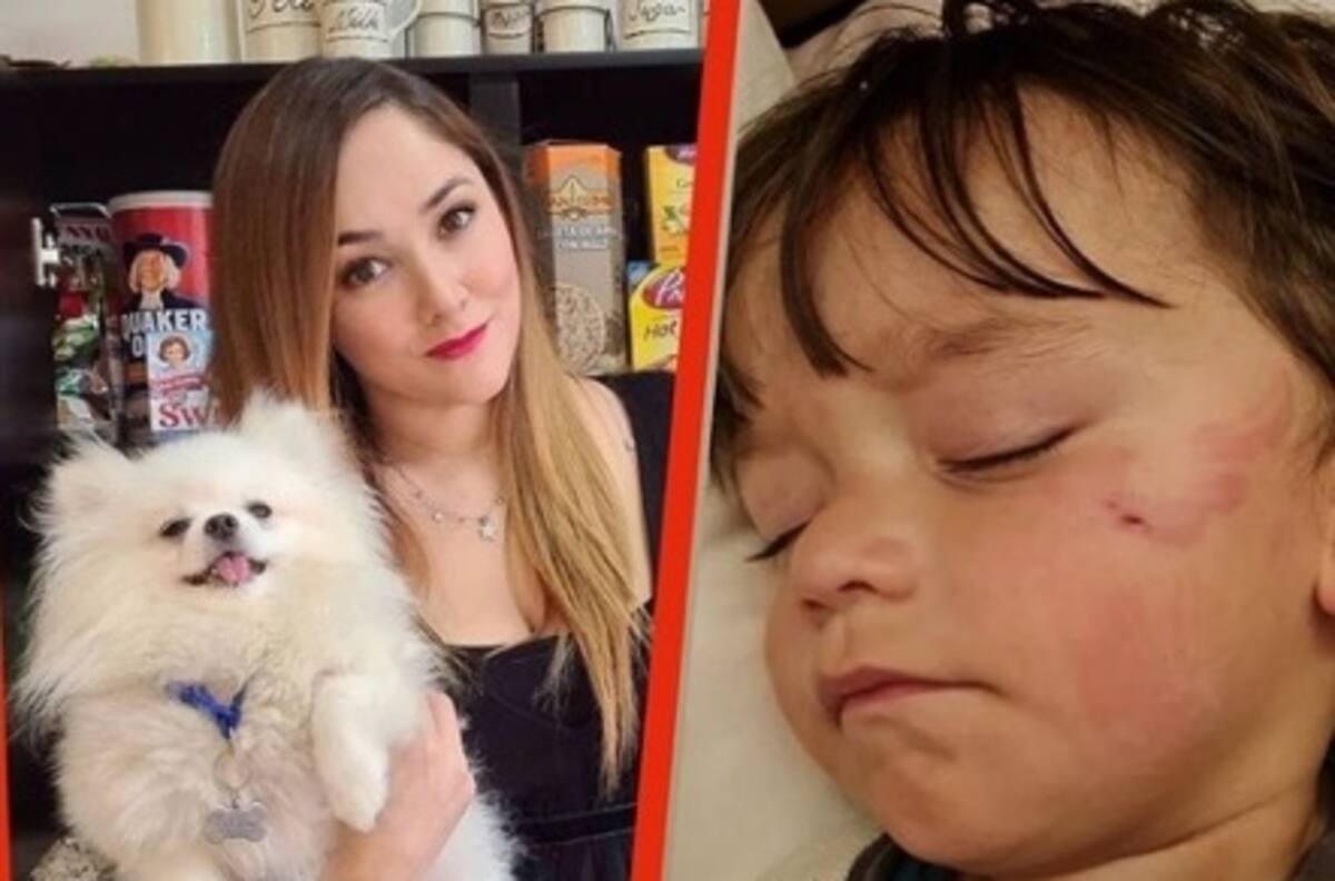 Sherlyn cura con remedios caseros a su hijo mordido por su perro