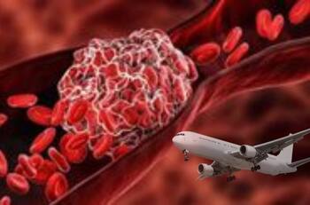 Viajar en avión no crea riesgo de trombos a los vacunados contra el COVID 19