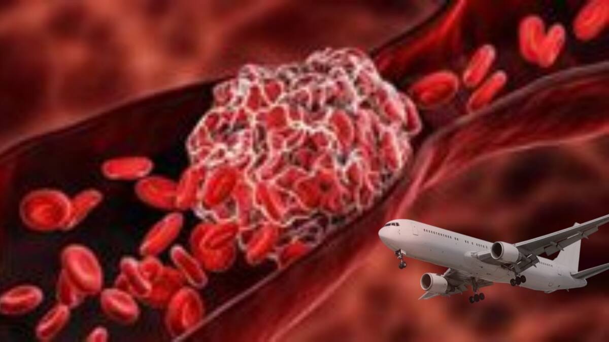 Viajar en avión no crea riesgo de trombos a los vacunados contra el COVID 19