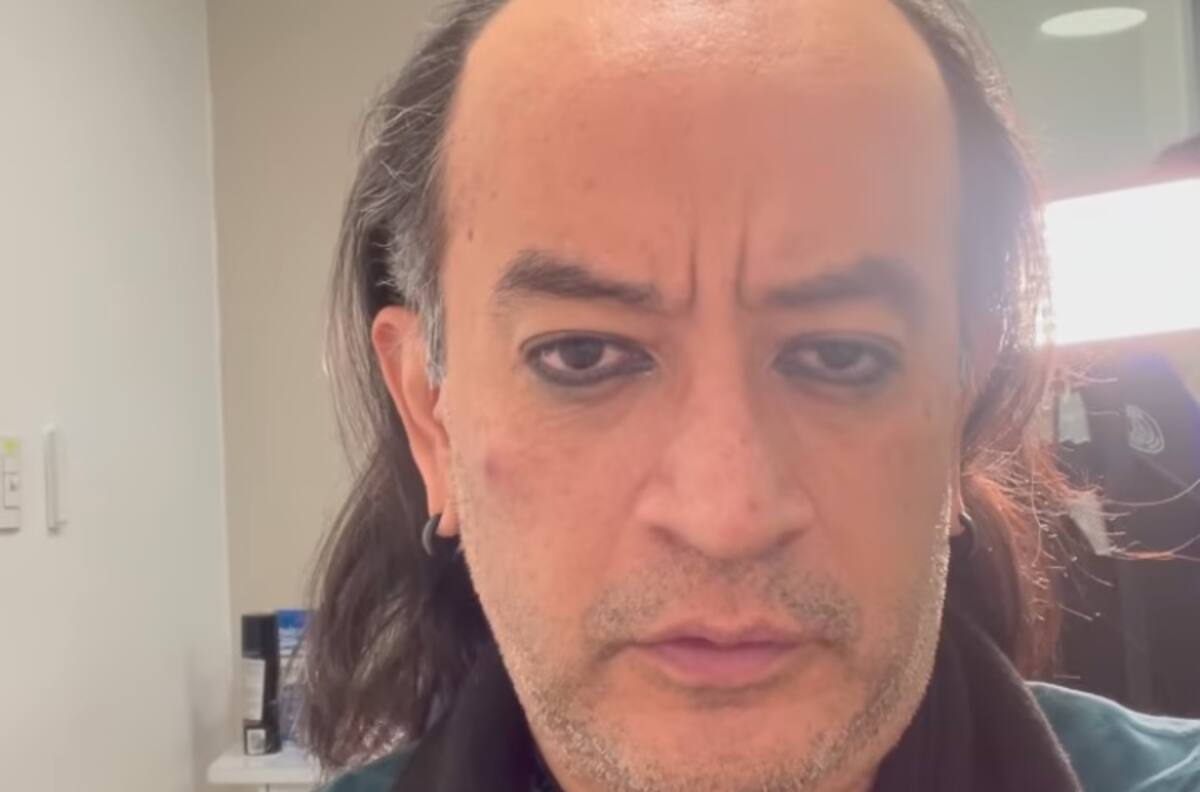 Germán Ortega presume los resultados de su injerto de cabello
