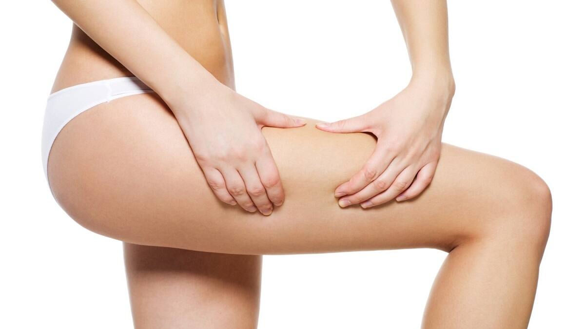 Belleza: Tips para eliminar las estrías de forma natural