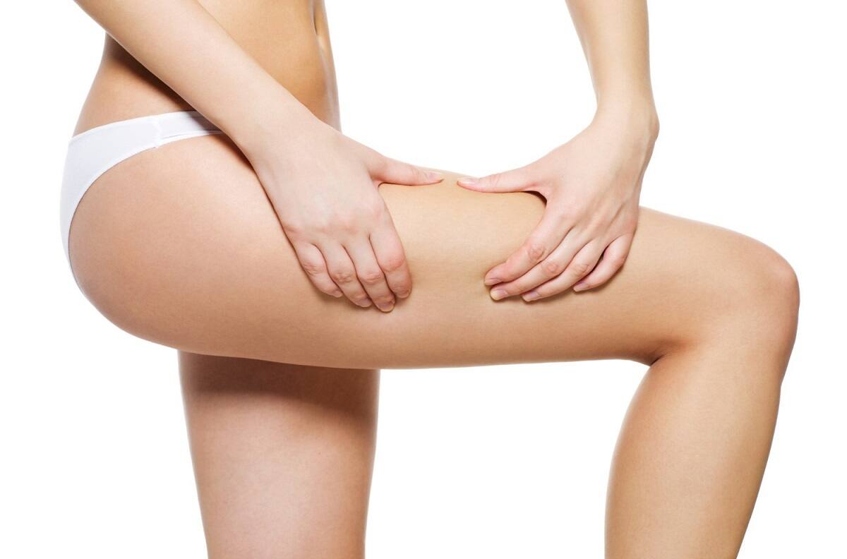 Belleza: Tips para eliminar las estrías de forma natural