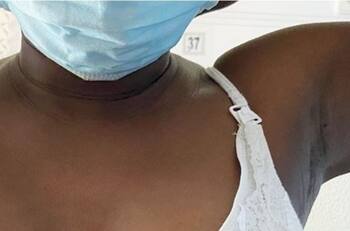 Fotos: Mujer comienza a lactar a través de su axila