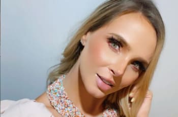 Modelo colombiana mostró sus glúteos destruidos tras una cirugía estética