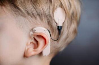 Día del Implante Coclear: Avance médico para oír de por vida ¿Qué es y cómo funciona?