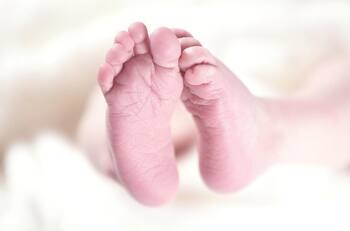 Fotos | Bebé nació con cuatro brazos y cuatro piernas: le dicen “milagro de la naturaleza”