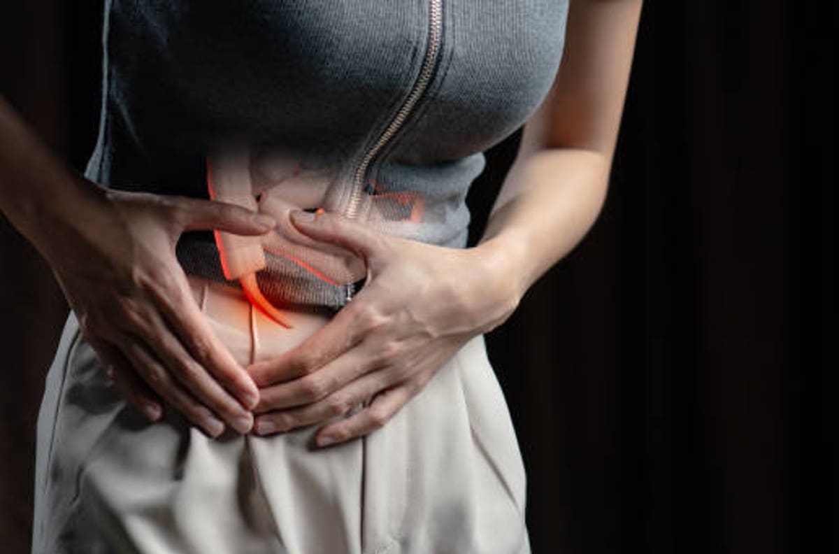 Salud: ¿Cuáles son los síntomas de apendicitis? Conocerlos podría salvarte la vida