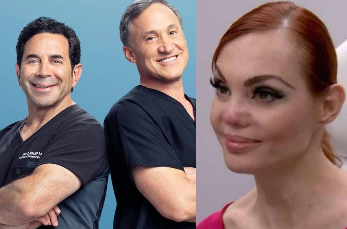 Carmen Campuzano reaparece con nueva nariz después que en Botched se negaran a operarla