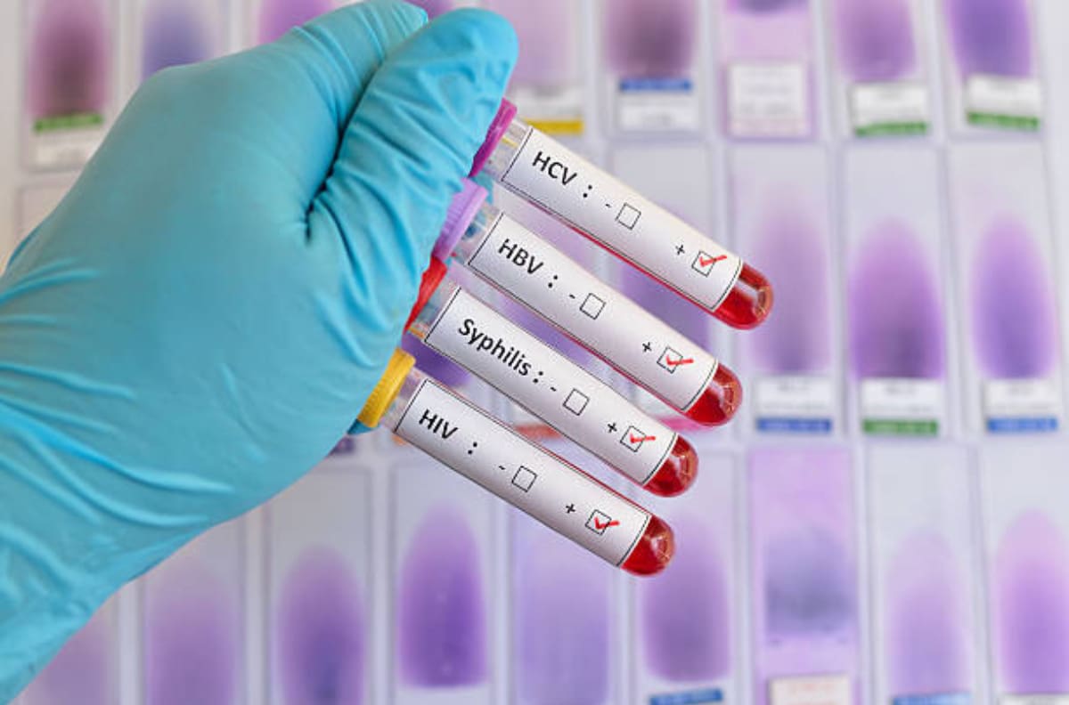 Estos son los mejores métodos para prevenir una ETS ¡Cuídate!