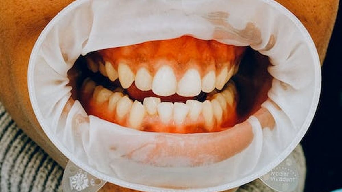 Salud: Estas son 3 señales de que te estás cepillando los dientes con más fuerza de la que deberías