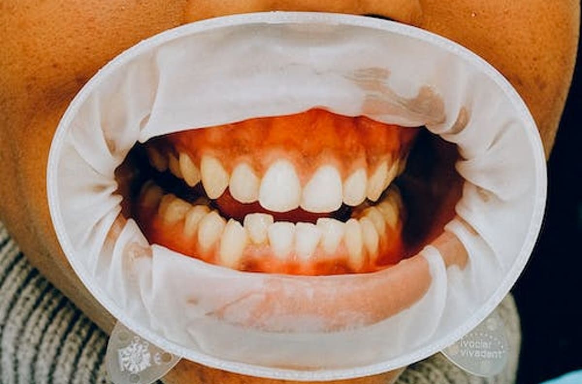Salud: Estas son 3 señales de que te estás cepillando los dientes con más fuerza de la que deberías