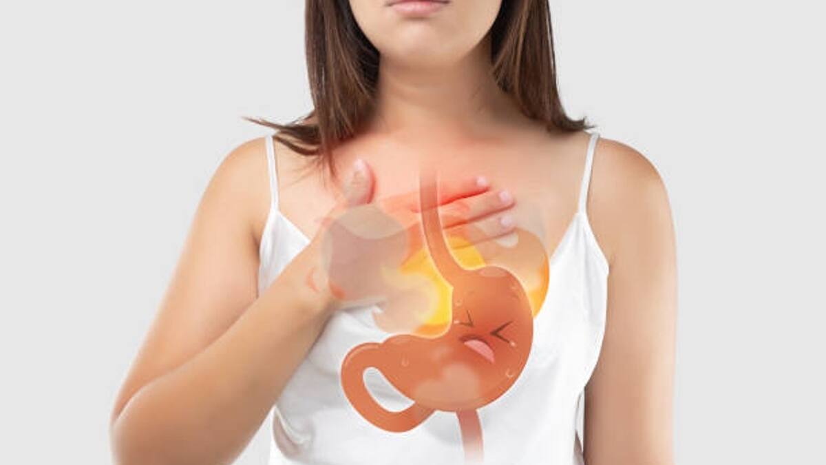Salud: 5 alimentos que alivian los molestos síntomas de reflujo