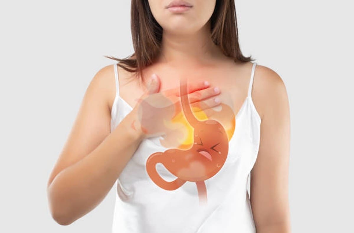 Salud: 5 alimentos que alivian los molestos síntomas de reflujo