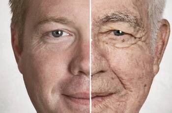 Descubren como retrasar el envejecimiento de la piel