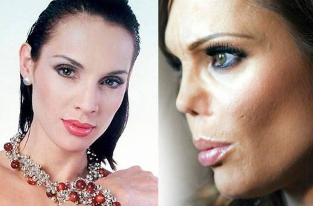 "Un mexicano pudo lo que en EEUU me negaron": Carmen Campuzano muestra su nueva nariz