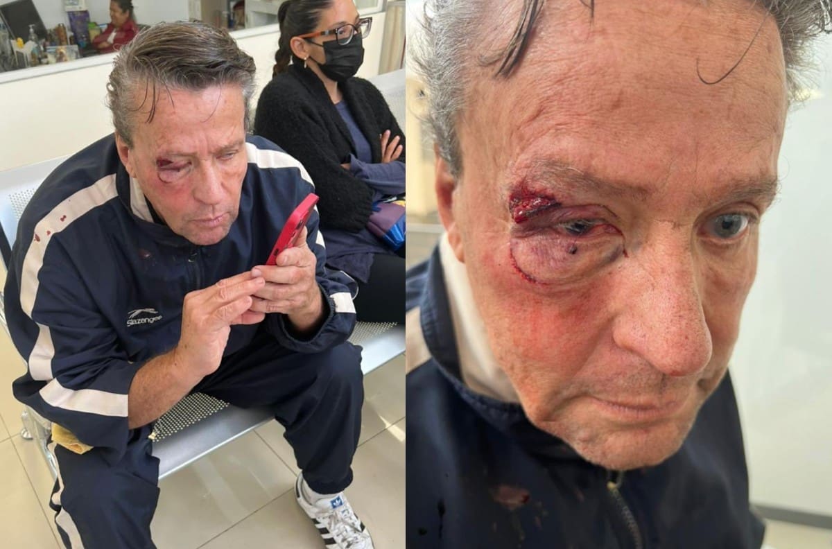 Alfredo Adame explica porqué recibió tremenda golpiza afuera de su casa