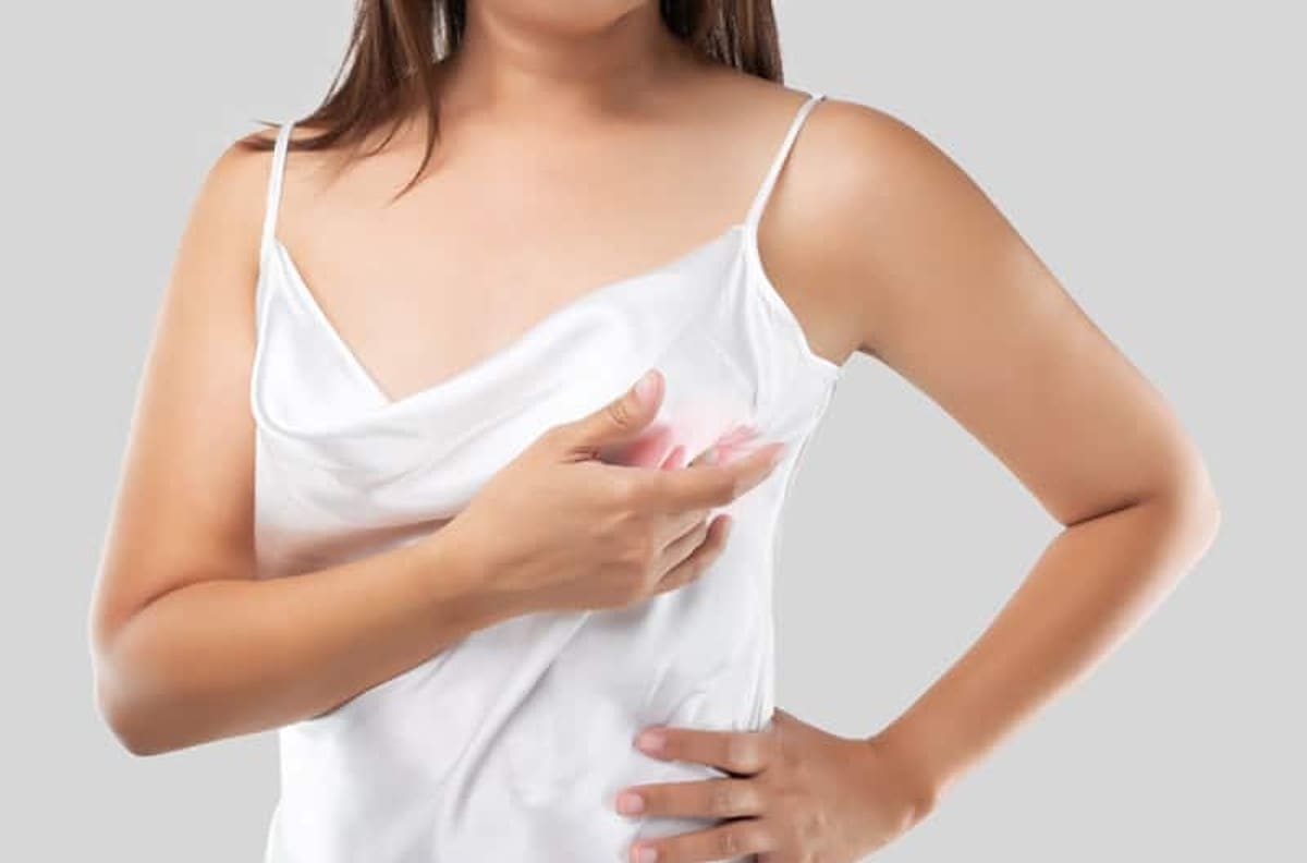 Salud: ¿Tienes pezones saludables? 6 cambios que deben preocuparte