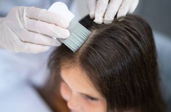 VIDEO: ¡Hay un poco de cabeza en tus piojos! Hace tratamiento a clienta y se vuelve viral