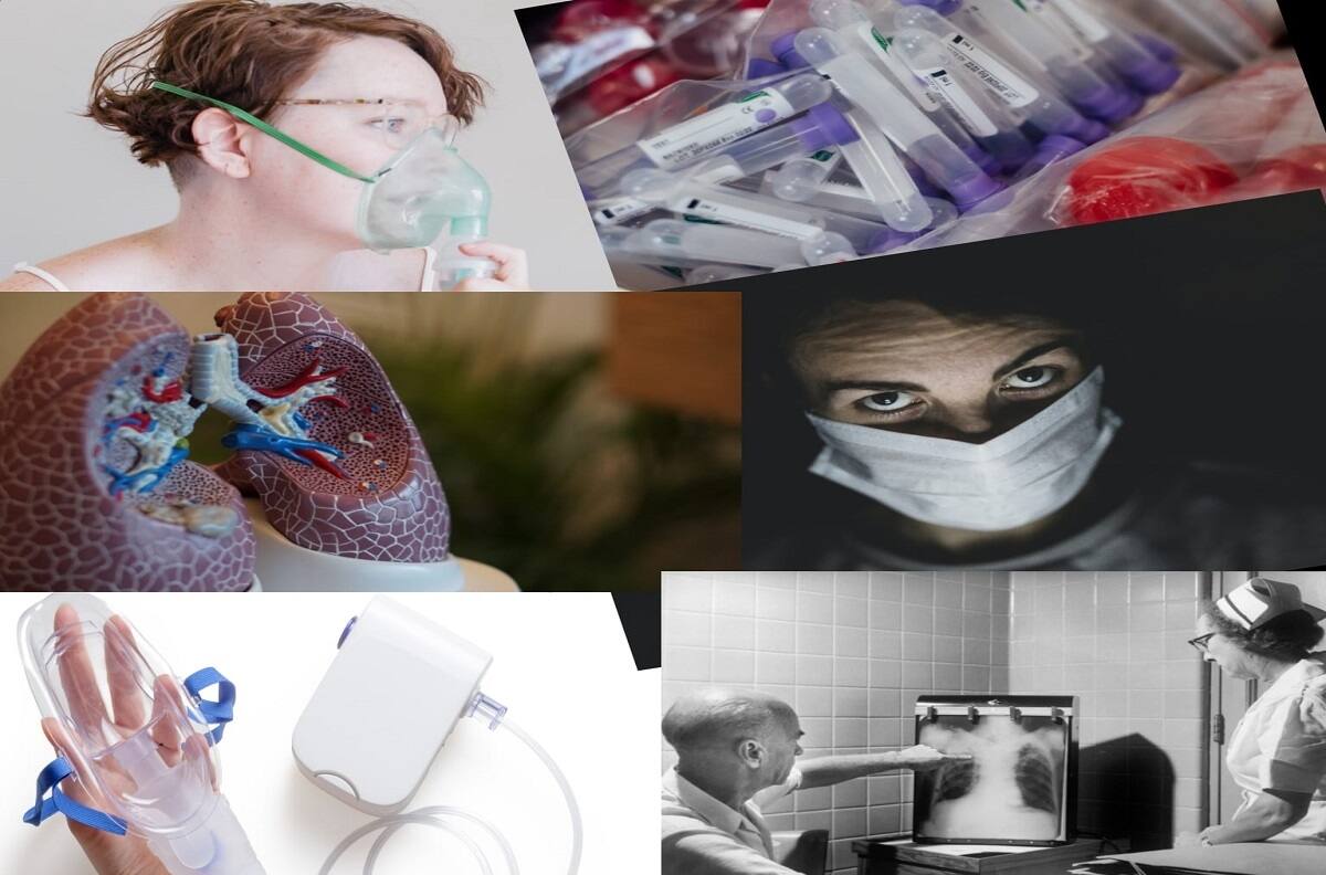 COVID 19: Conoce las diferencias entre la reparación pulmonar de hombres y mujeres