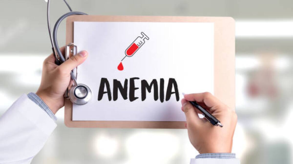 Salud: Estos son algunos síntomas de anemia ¡Cuidado!