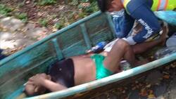 Hombre es atacado por un lagarto en Catemaco, Veracruz