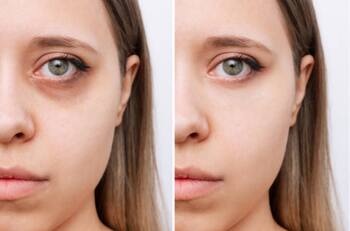 Belleza: Te presentamos al mejor corrector de ojeras del 2022