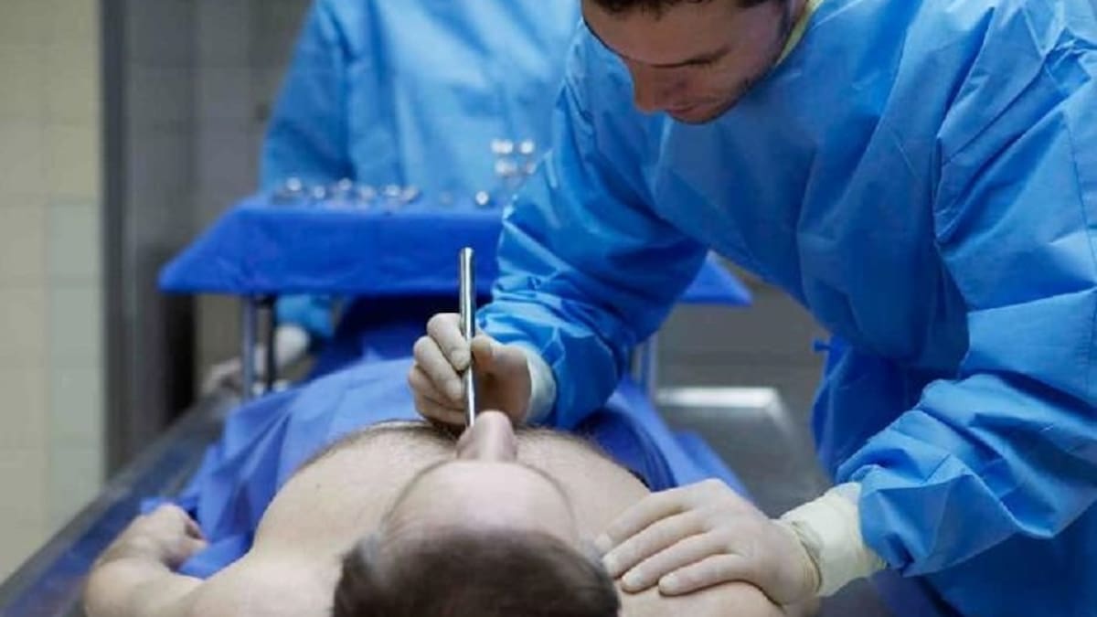 Declaran muerto a hombre y revive antes de que le realicen la autopsia