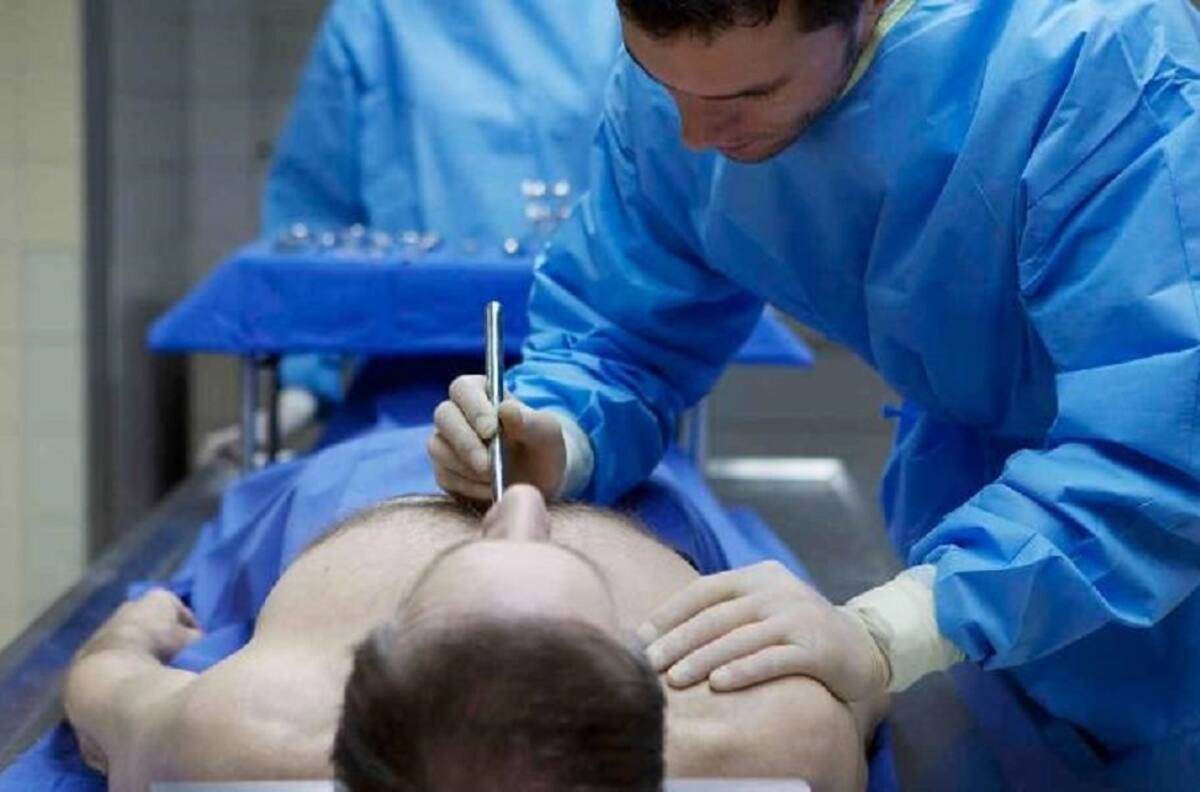 Declaran muerto a hombre y revive antes de que le realicen la autopsia