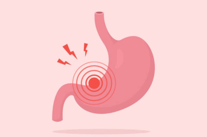 Existen algunos alimentos que deberás eliminar de tu dieta si padeces gastritis.