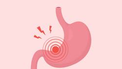 Estos son los alimentos que debes eliminar de tu dieta si padeces gastritis