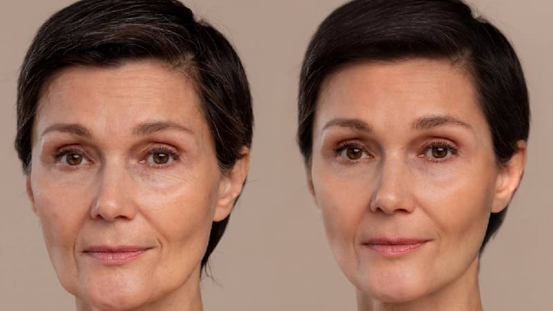 Con estos tres consejos podrás revertir los signos de la edad.